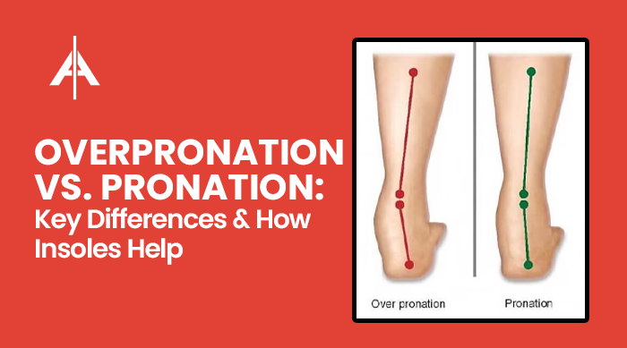 Illustration showing biomechanical differences between overpronated and normally pronated feet.