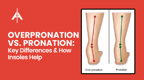 Overpronation vs. Pronation: Key Differences & How Insoles Help