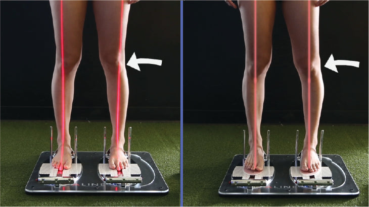 Person getting fitted for ALINE Insoles for better alignment.
